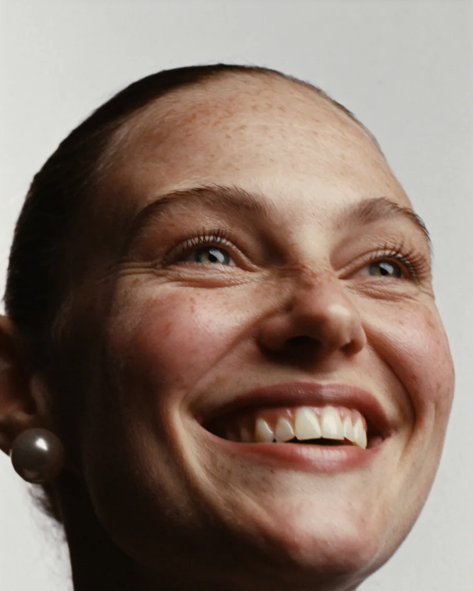 Close-up of a woman laughing, with natural fine lines and freckled skin, for fine lines and wrinkles at Palm Lux Aesthetics